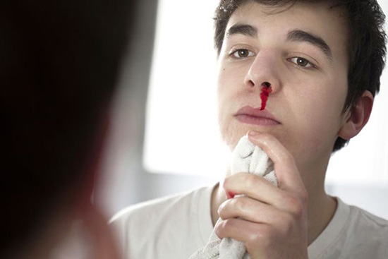Vì sao nhiều trường hợp hay chảy máu mũi vào mùa thu